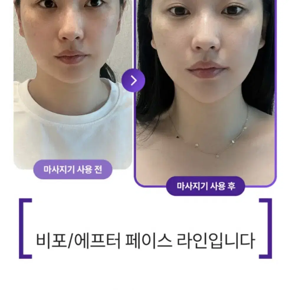 피부 마사지기(롤러. 괄사. LED)