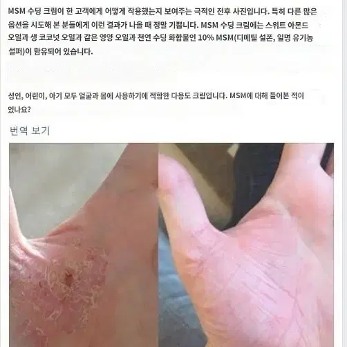 이시영 유황수분크림