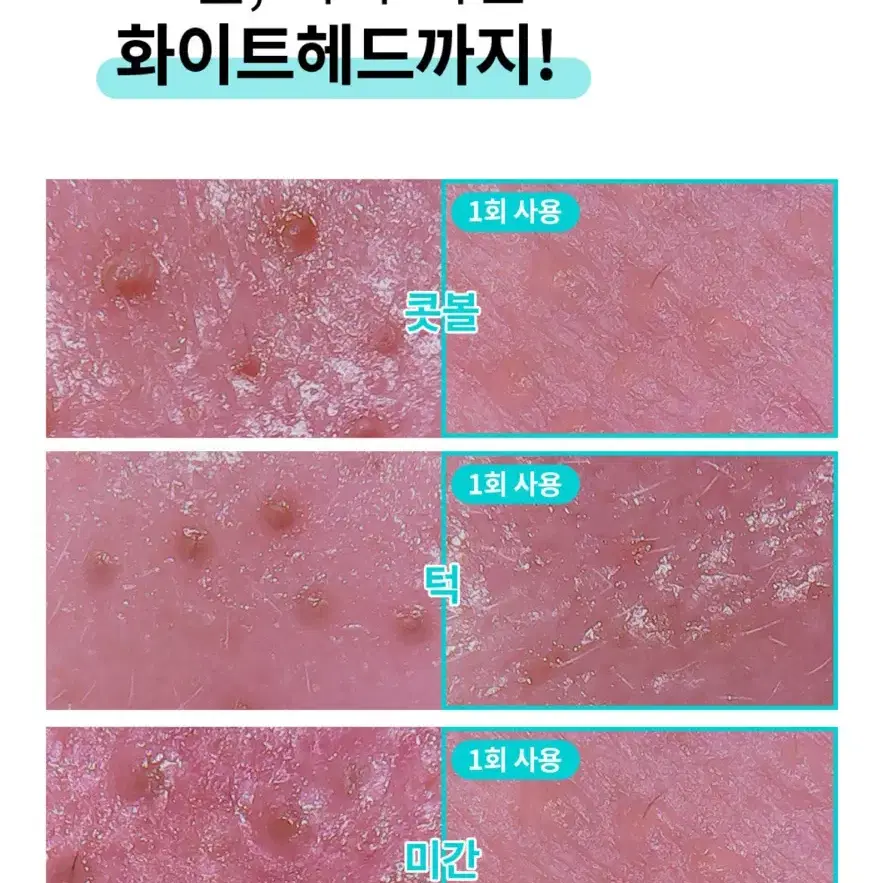 페이스팩토리 각질 피지제거 제로필링기