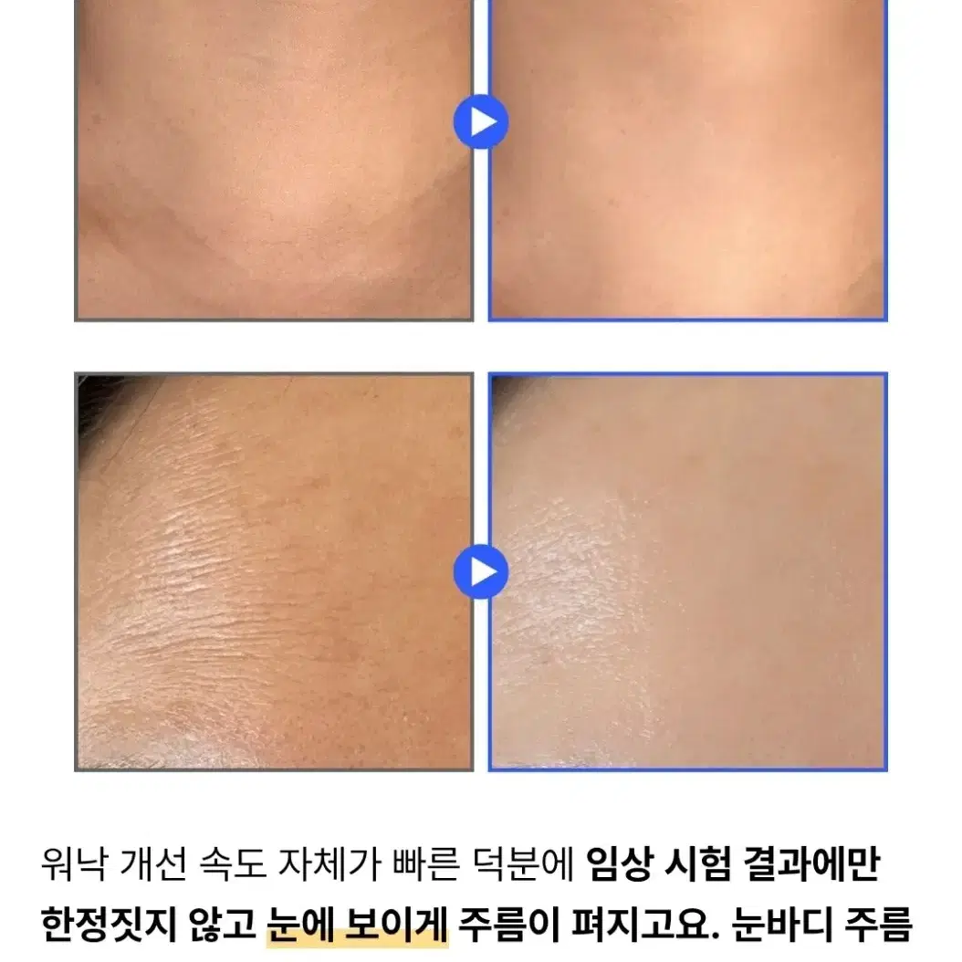 미백 기미 모공 팔자주름 탄력 300달톤 저분자 레티노이드 세럼