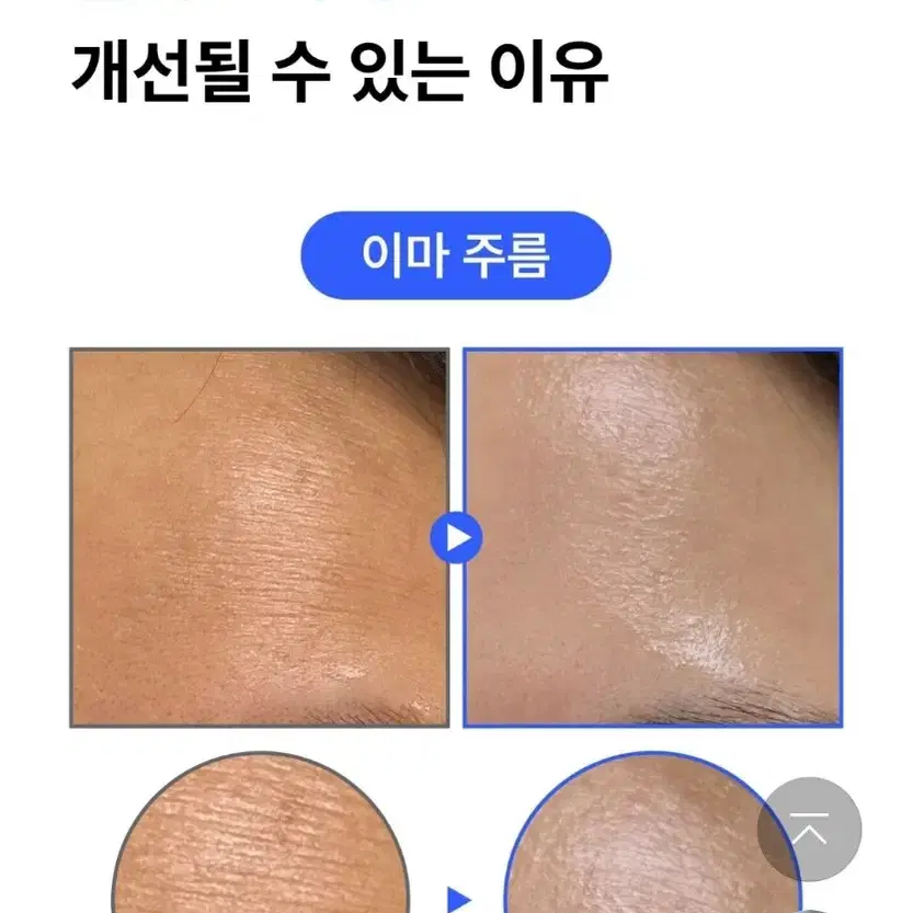 미백 기미 모공 팔자주름 탄력 300달톤 저분자 레티노이드 세럼