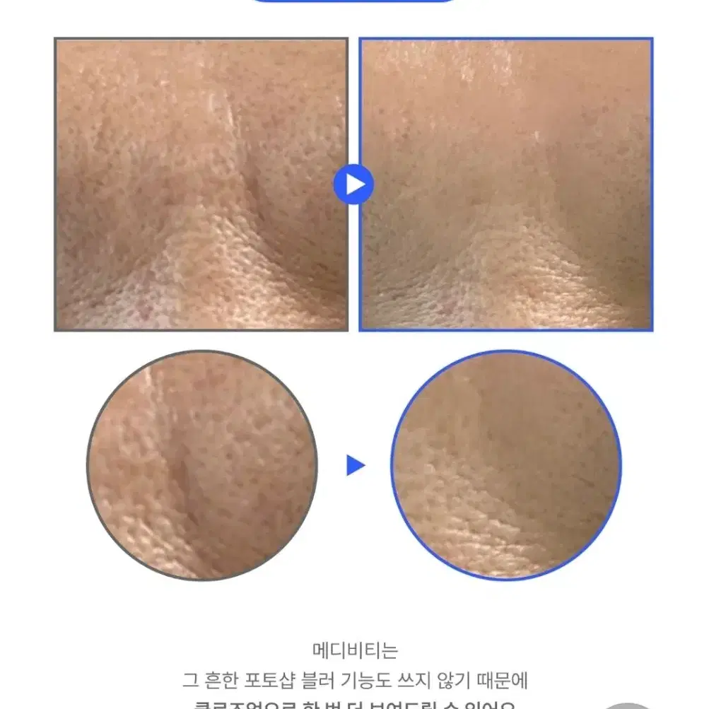 미백 기미 모공 팔자주름 탄력 300달톤 저분자 레티노이드 세럼