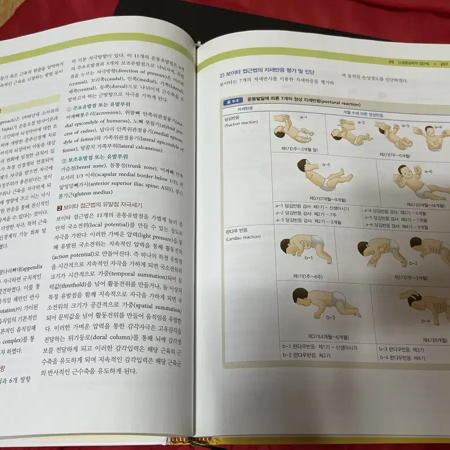 소아 물리치료