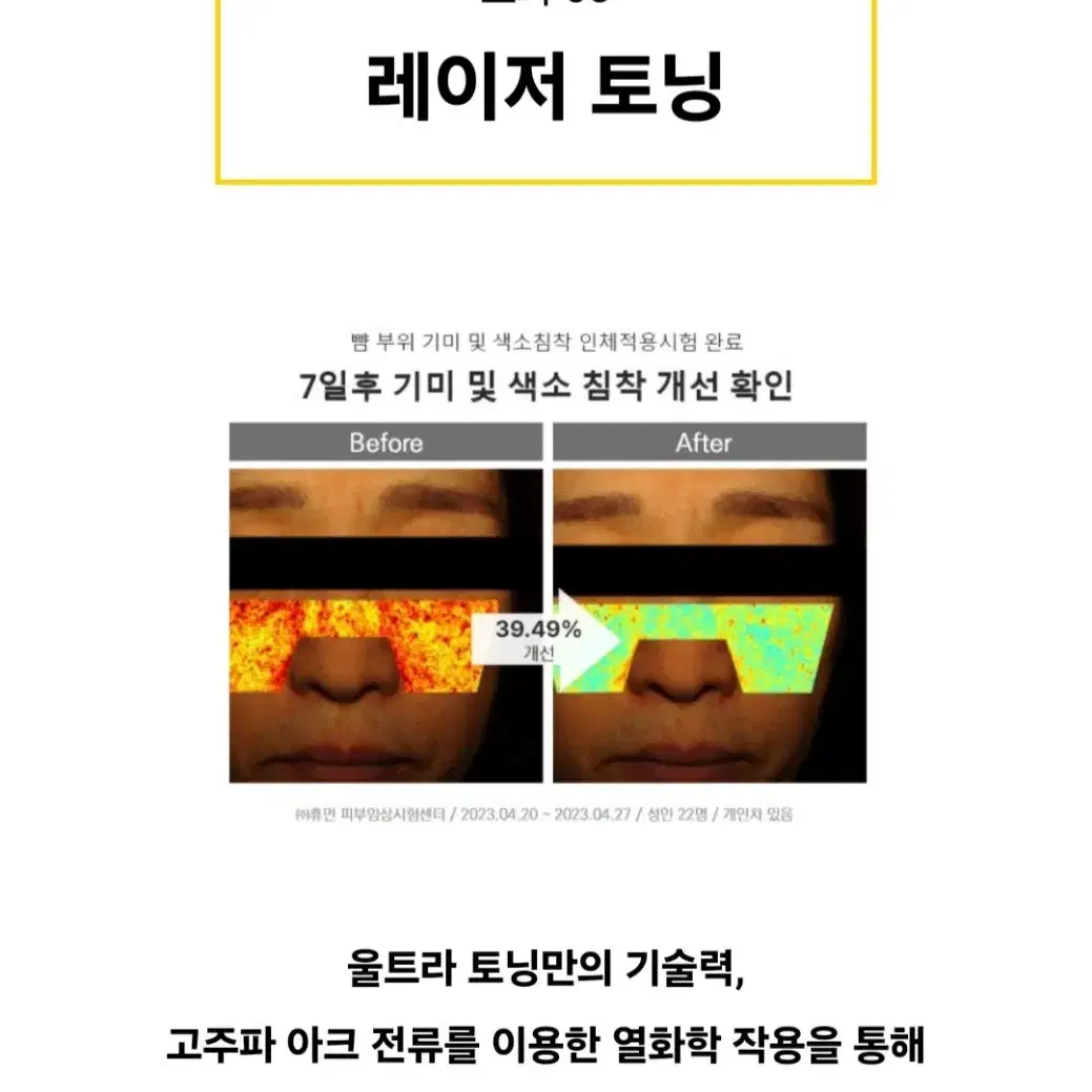 <무배> 셀피온 울트라토닝 + 전용앰플