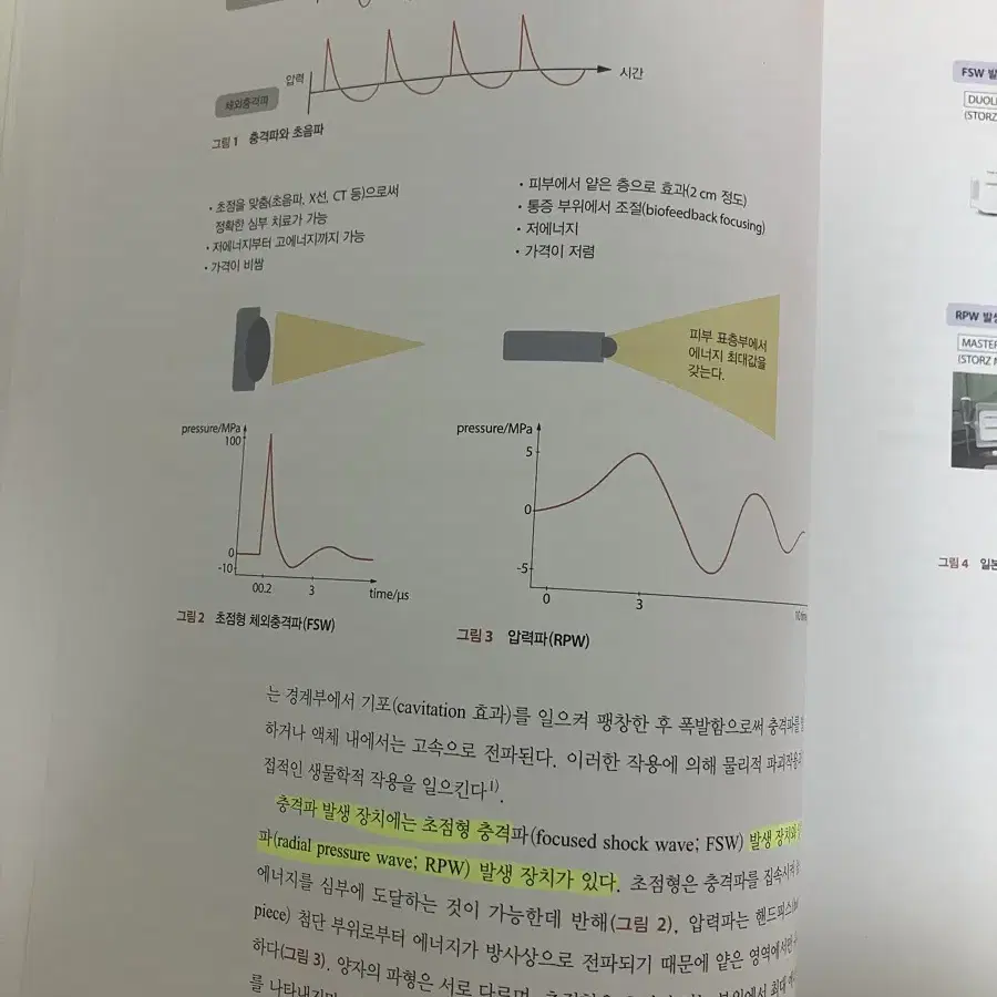 체외충격파 근골격계 치료의 이노베이션