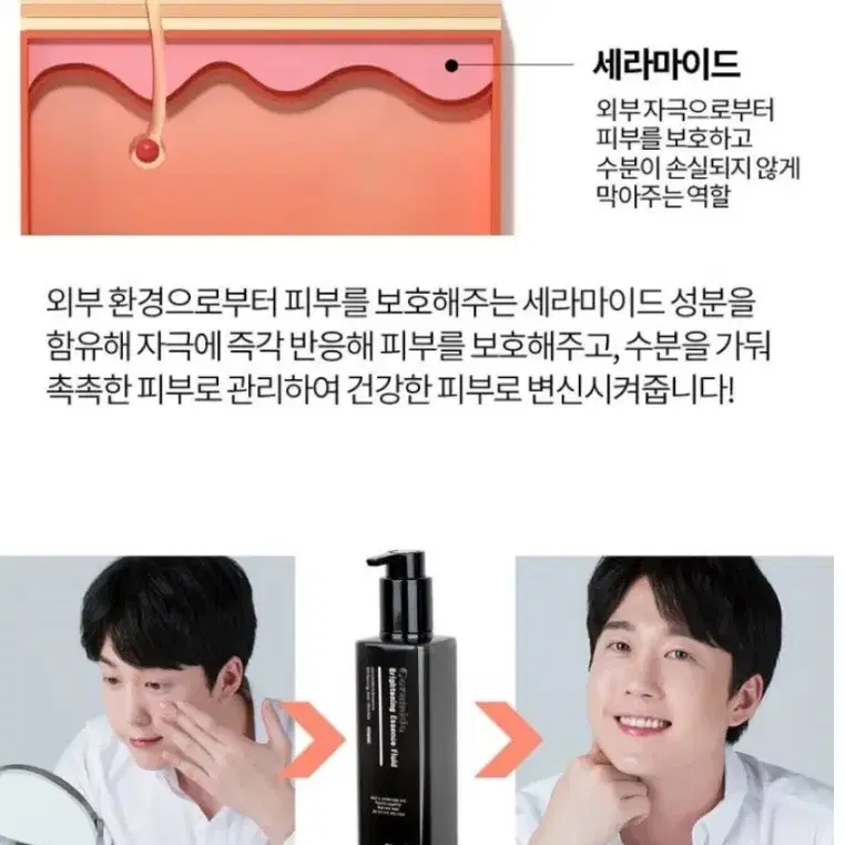 남성용 올인원 기미액스