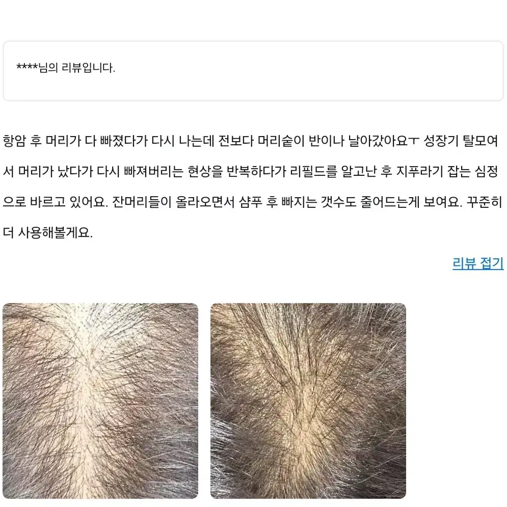 리필드 헤어토닉 3개(탈모완화제품)