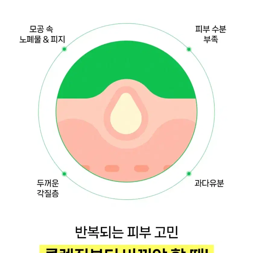 [미개봉 새상품] 아크네스 포밍워시 200ml