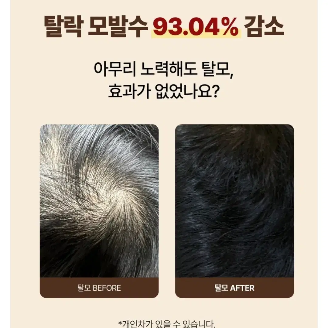 새상품) 미디엘 맥주효모 탈모 증상 완화 리바이탈라이징 샴푸, 1015g