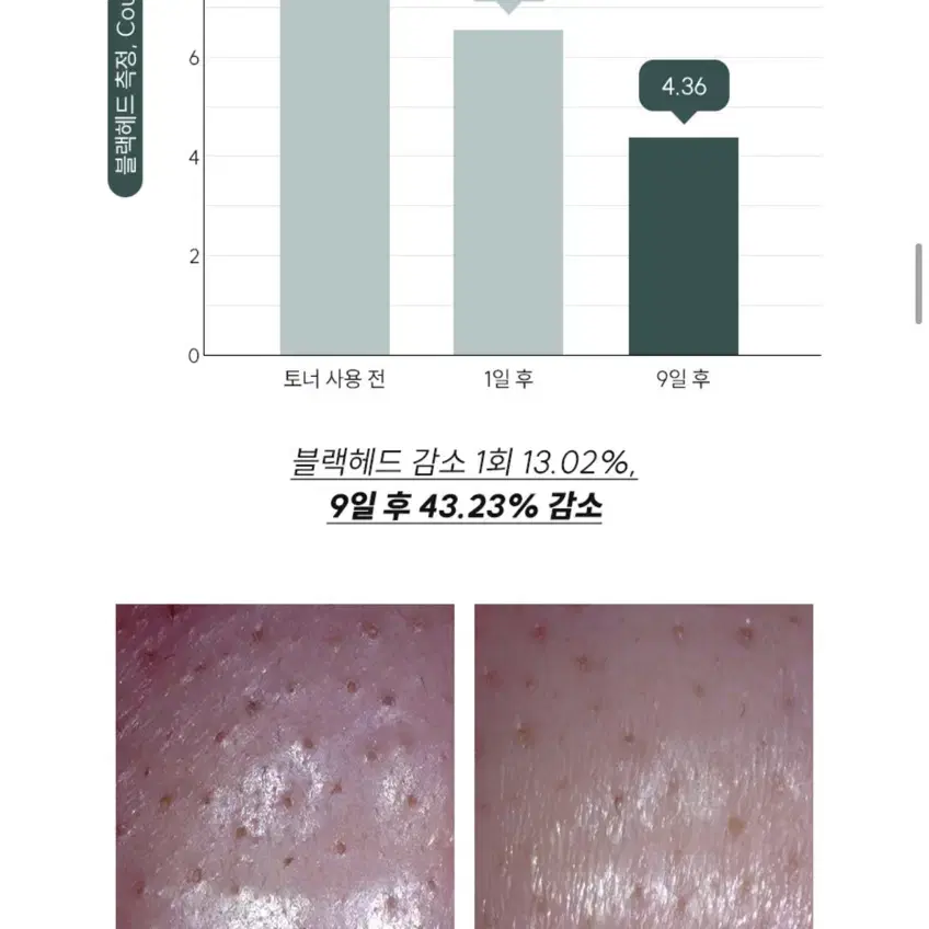 (무배) 닥터트웬티프로젝트 수분 진정 나인 9 토너 300ml