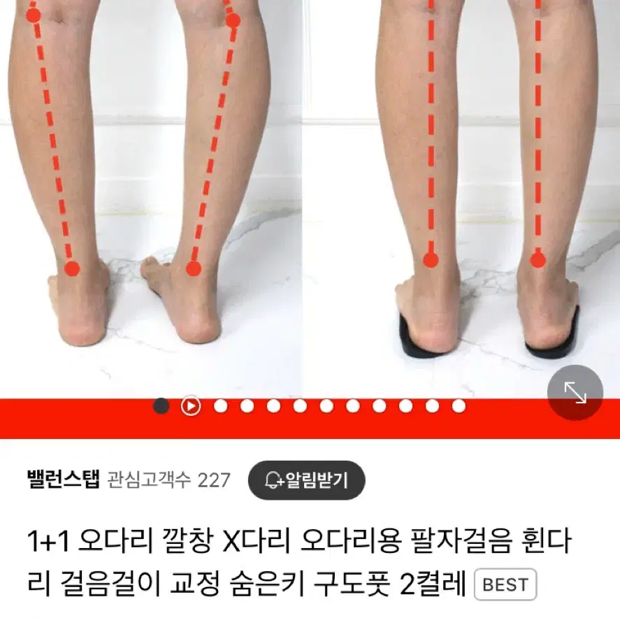 O자다리 교정 깔창