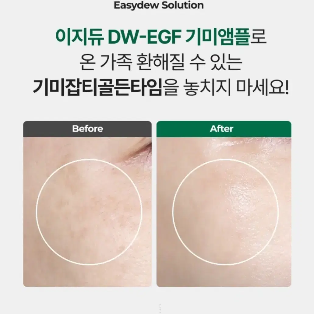 [이지듀] EGF 기미앰플 15ml+0.7ml 세트 (새상품)