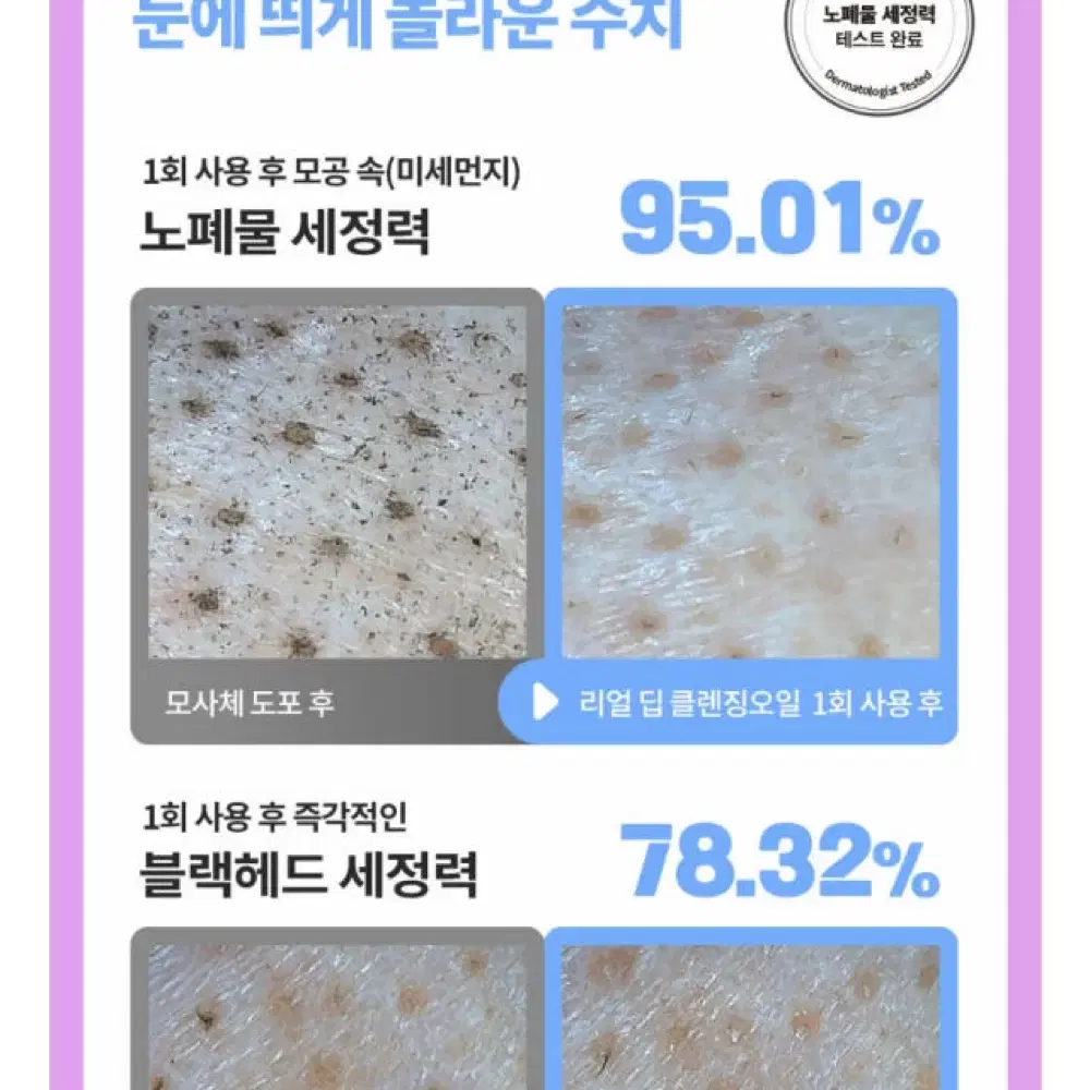 미개봉새상품)오르제나 리얼 딥 클렌징 오일 비건오일 블랙헤드 피지관리