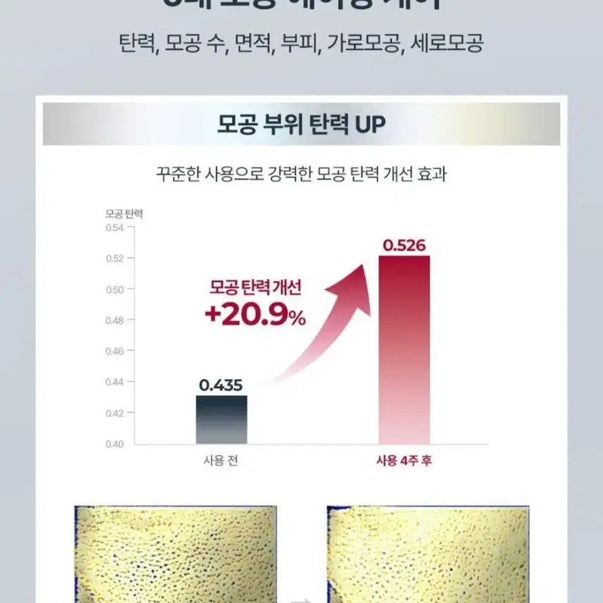 유세린 에피셀린 세럼 30ml(새상품)