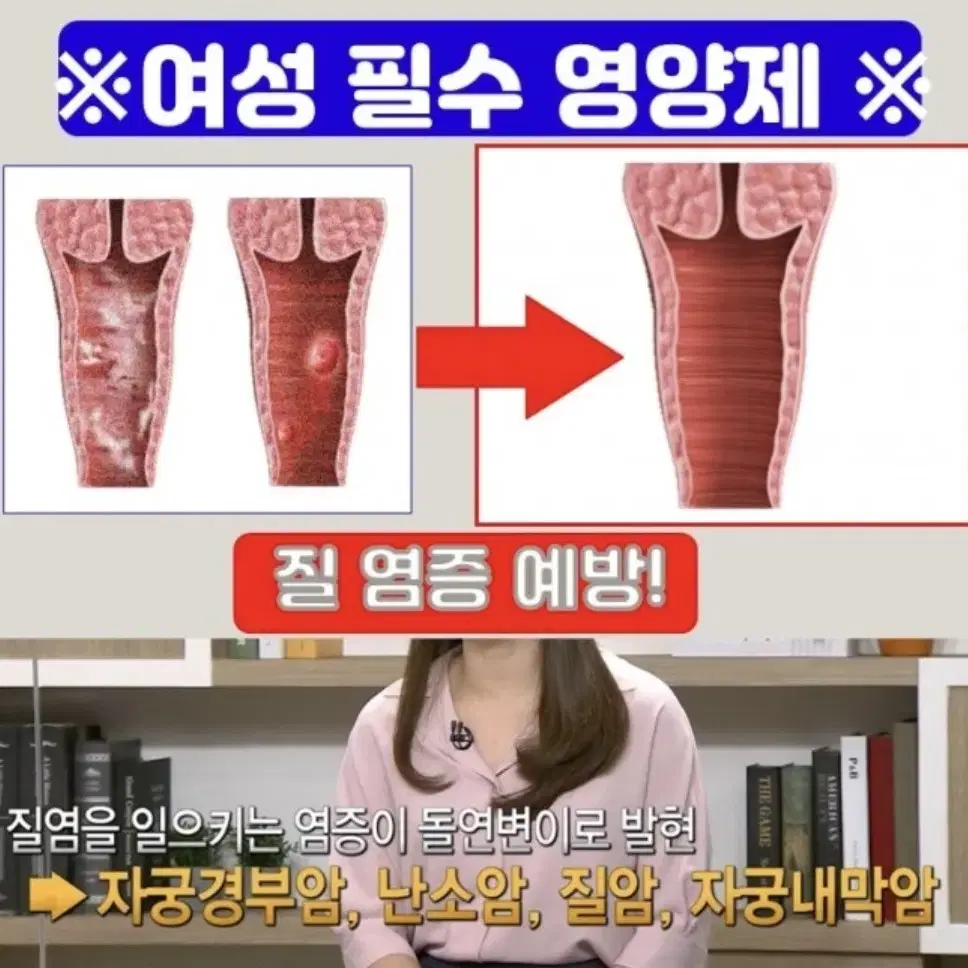 여성 질 유래 유산균 임산부 질건강 추천 락토바이오우먼 90캡슐 3개월