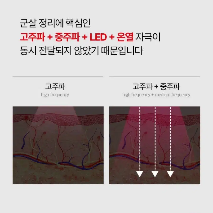 휴그랩 고주파 EMS LED 지방케어 기기