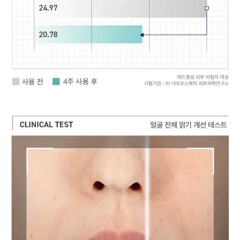 메디힐 마소카소사이드 흔적패드 더블기획