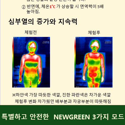 고주파자극기 고주파 심부온열 {뉴그린}