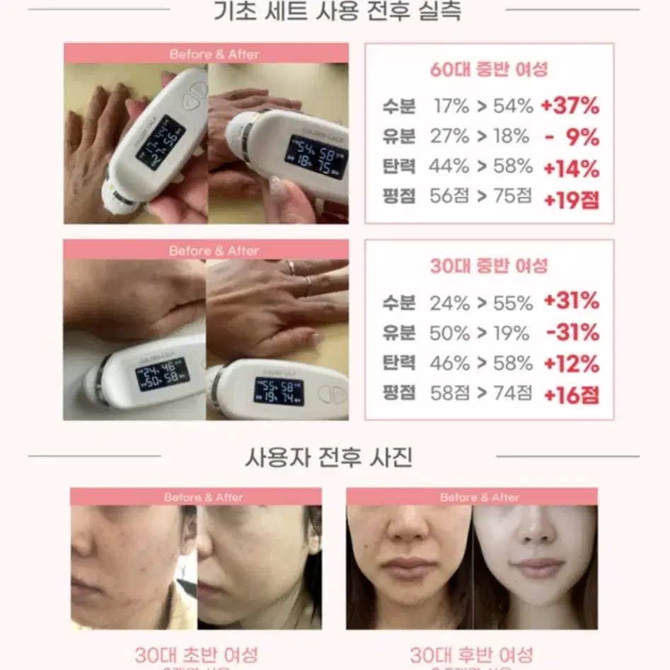 6일만에 차오르는 볼륨 72시간만에잡히는 윤곽 엑스퍼트 케어크림31