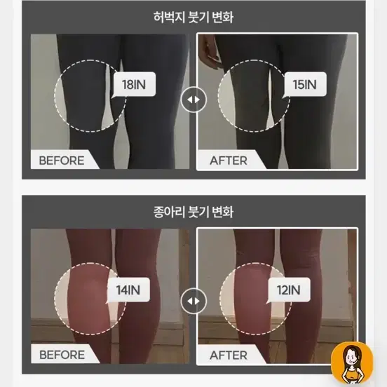 다이어트학교 붓기제거 리압토즈 지압슬리퍼 하체부종