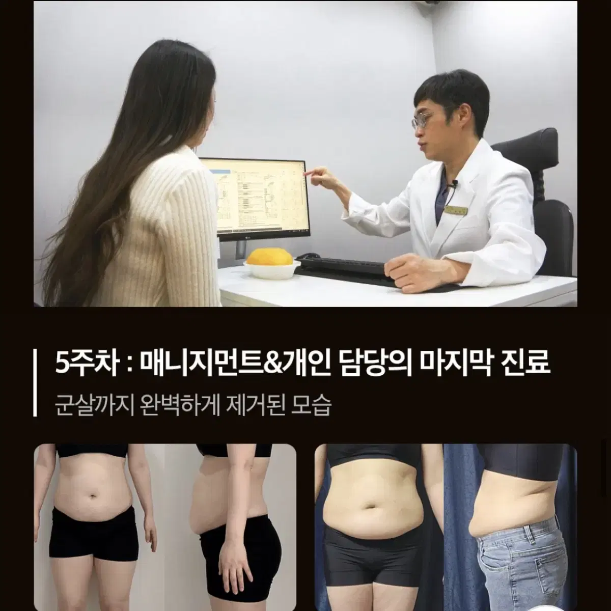 상상의원 신사본점 VVIP센터 MPL 시술권 양도