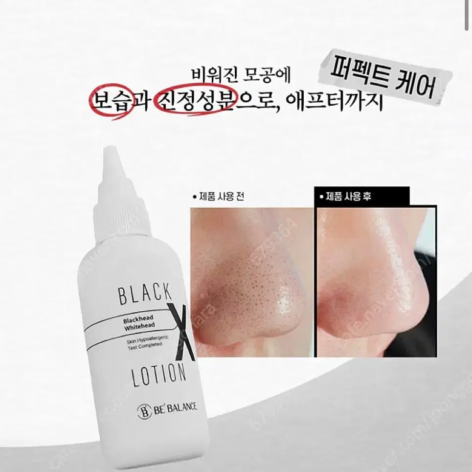 새상품 비밸런스 블랙 엑스 로션 모공 청소 피지 블랙헤드 쿄즈