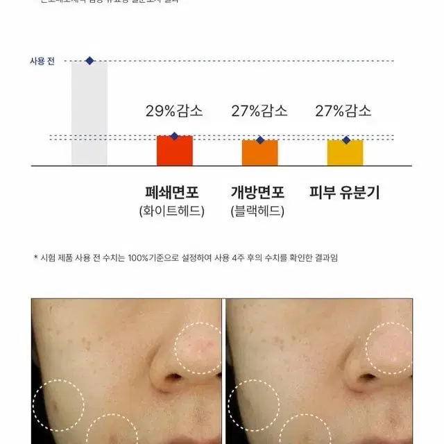 새상품 퍼셀 20억/ml 픽셀바이옴 원액 15ml 여드름 개선