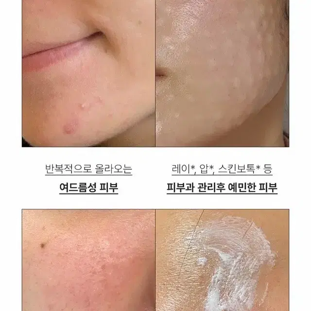 새상품 퍼셀 20억/ml 픽셀바이옴 원액 15ml 여드름 개선