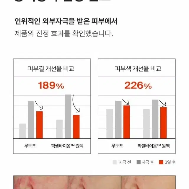 새상품 퍼셀 20억/ml 픽셀바이옴 원액 15ml 여드름 개선