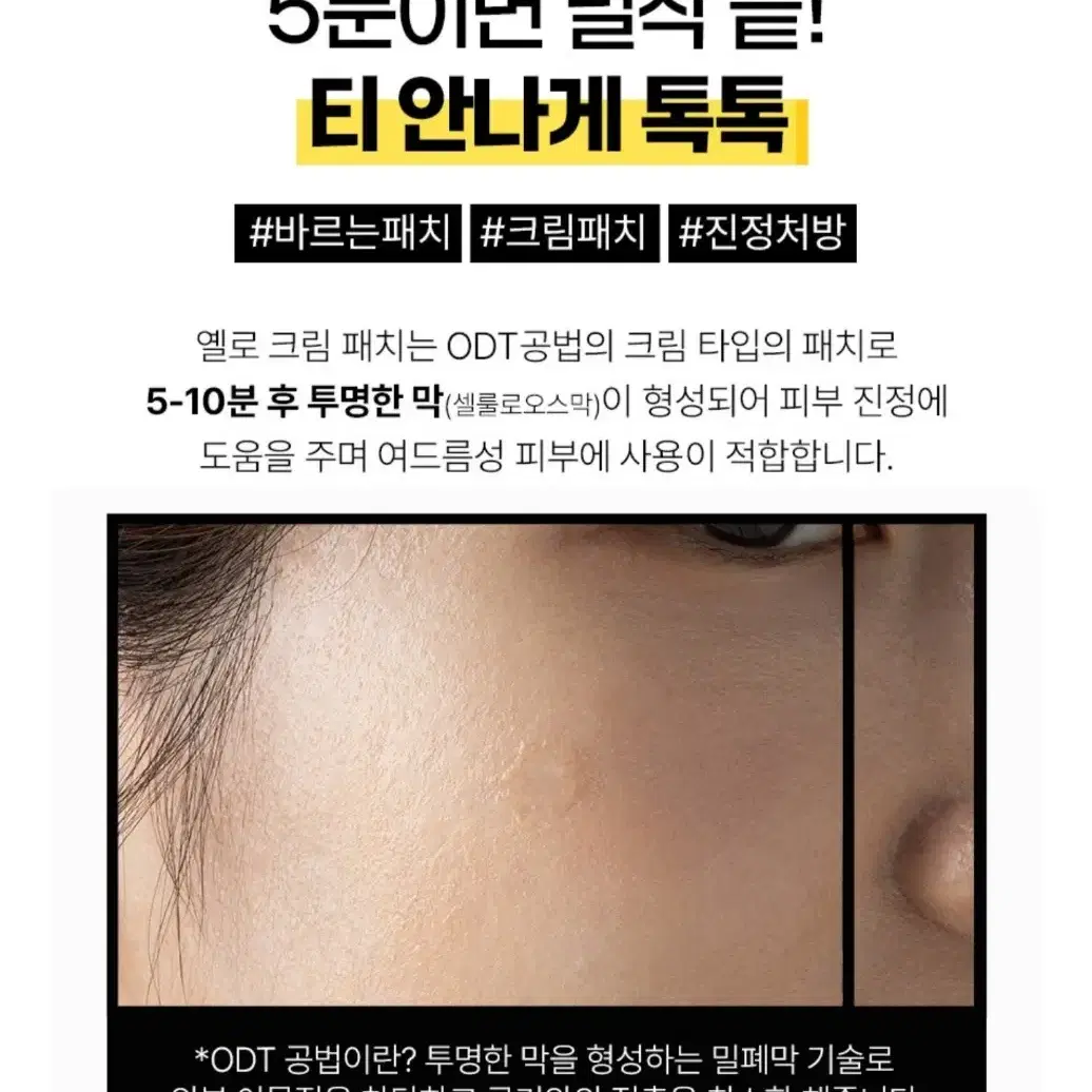 새상품 코코스타 옐로 스팟 크림 패치 여드름 진정 보호막