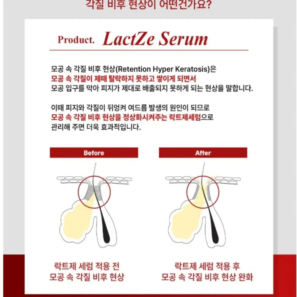 바이더퀄리티 락트제세럼 50ml