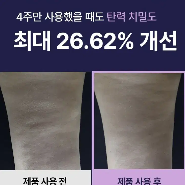 와이트닝 일체형 슬리밍 림프 괄사 크림