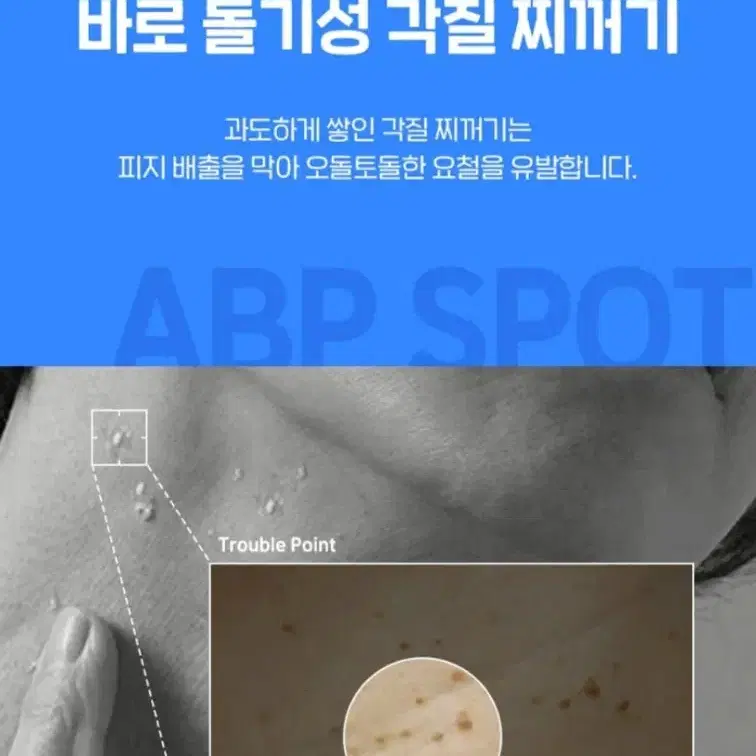 닥터딥 ABP 스팟 크림