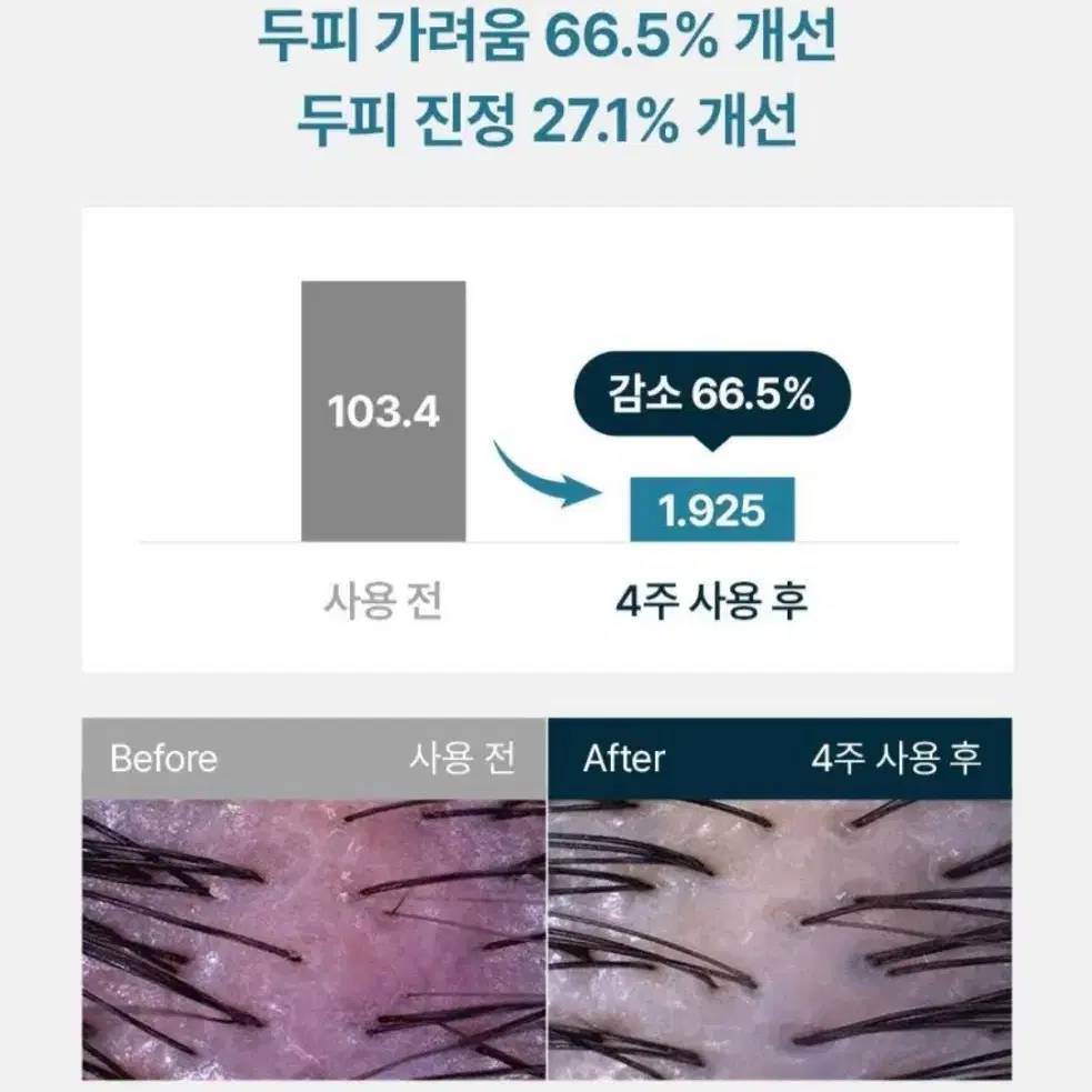 [화해1위] 솔랩 탈모/진정 두피영양제 가르마앰플 40ml