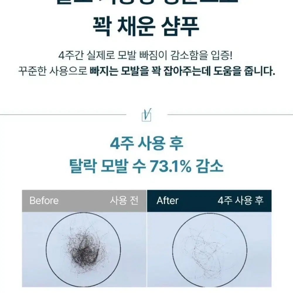 (올영1위)솔랩 탈모증상완화/가려움케어 샴푸 300ml(모발빠짐감소)