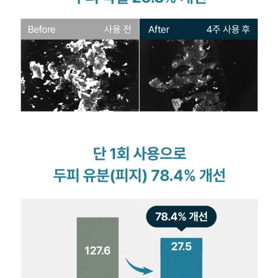 (올영1위)솔랩 탈모증상완화/가려움케어 샴푸 300ml(모발빠짐감소)