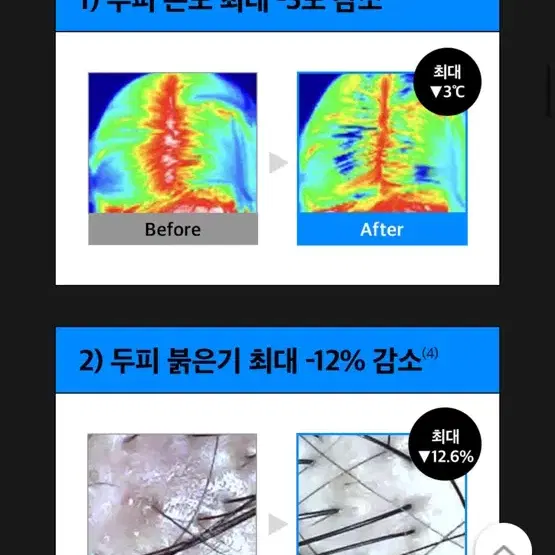 미개봉)탈모증상완화 리필드 사이토카인 부스터-두피/탈모 헤어토닉