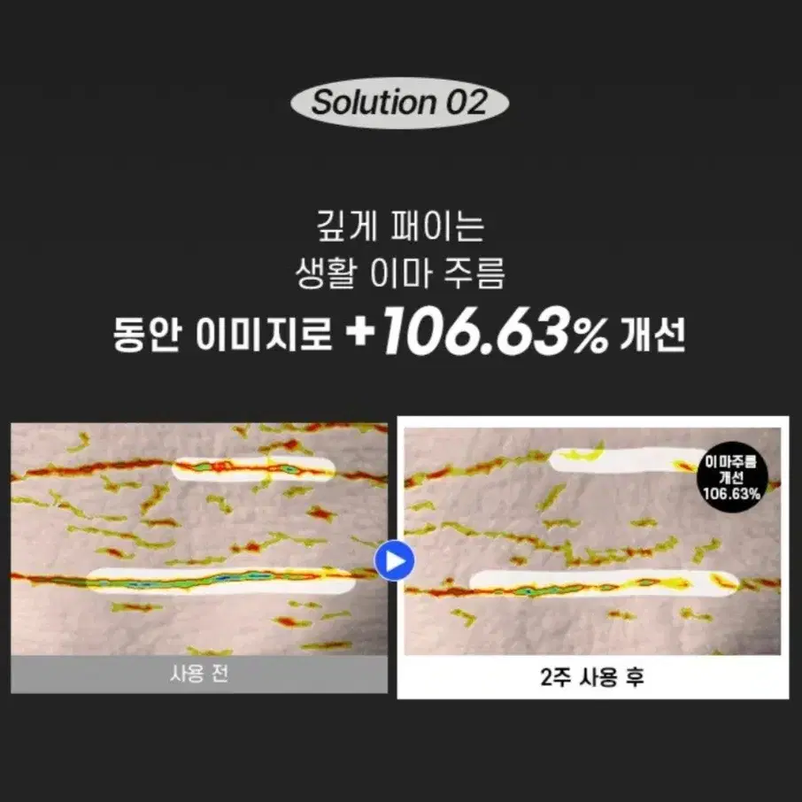 화사 진짜 펩타이드 5% 목 이마 입가 눈가 팔자 미간 6종 주름 개선