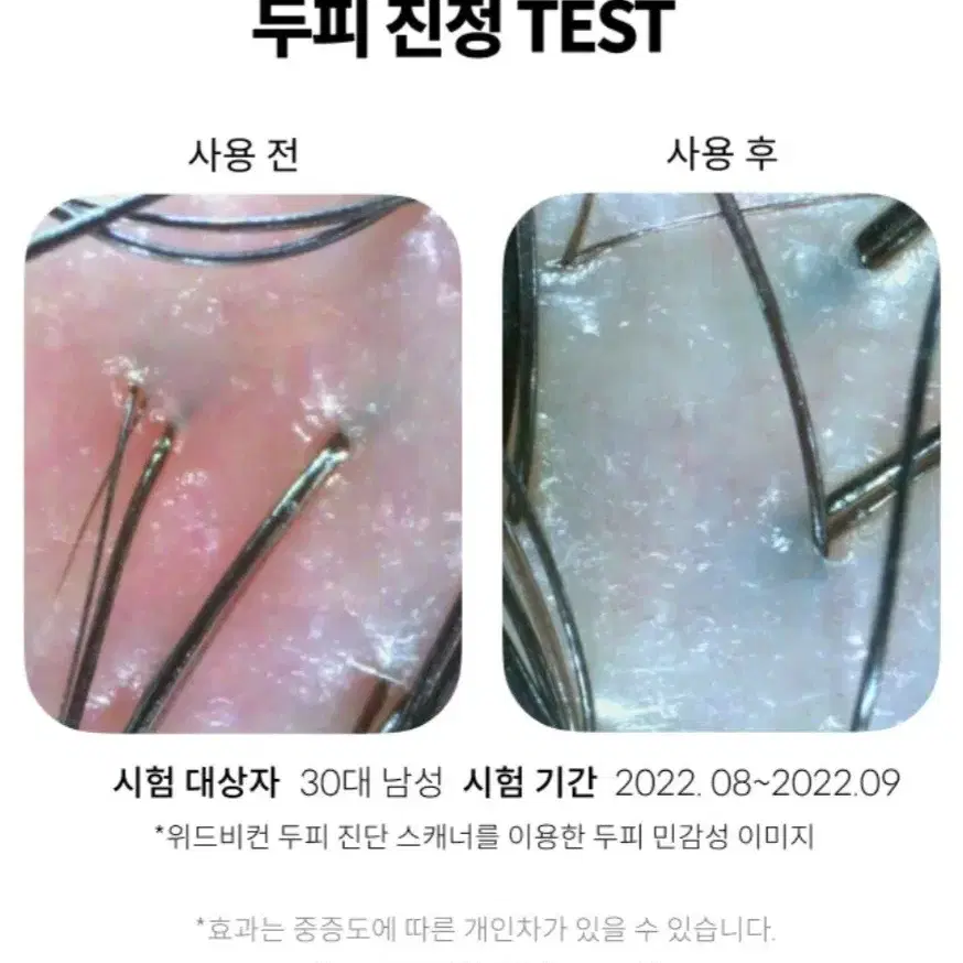 위드비컨 탈모증상완화 두피진정 너리셔집 앰플 30ml