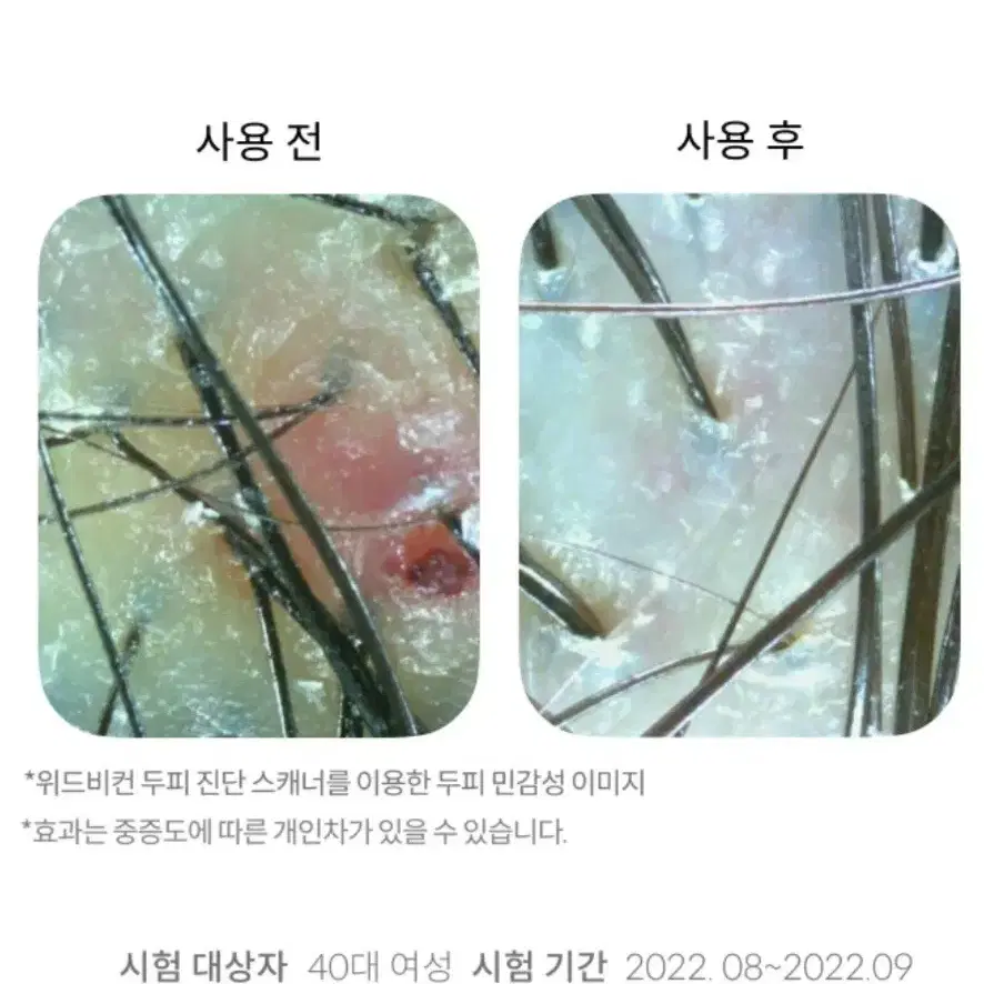 위드비컨 탈모증상완화 두피진정 너리셔집 앰플 30ml