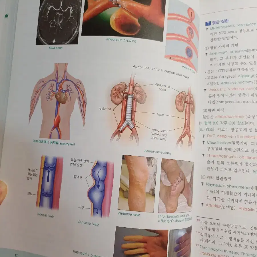 핵심 의학용어