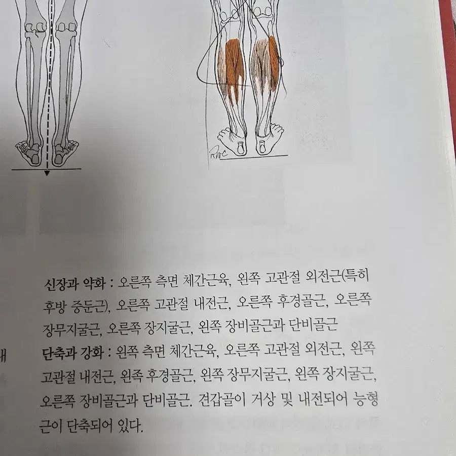 켄달 자세와 통증치료에 있어 근육의 기능과 검사