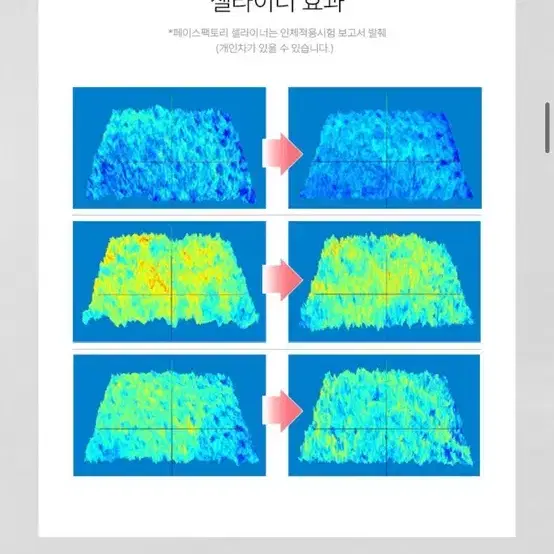 페이스팩토리 셀라이너 (주름개선, 미용기기)