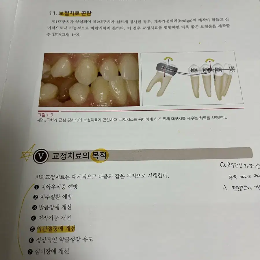 치과교정학 - 치위생 치과위생사 치위생학과