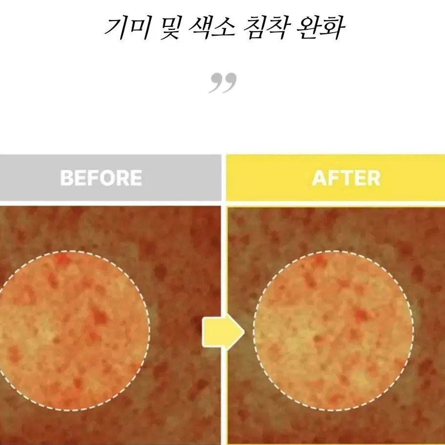 피부과 토닝기미 색소침착 완화 항산화 미백 피부톤까지 유자잡티세럼 60%