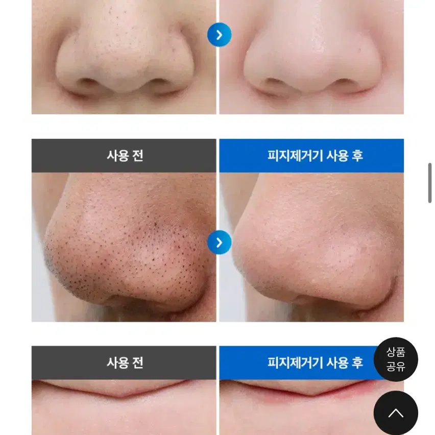 몬스터팩토리 모공 진공 제거기 새상품