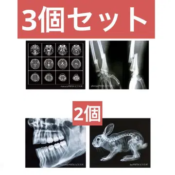렌트겐 라이트 X-RAY LIGHT 2개 세트 가챠가챠 캡슐 토이