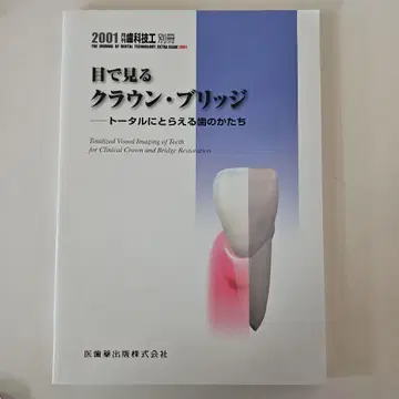 눈으로 보는 크라운 브릿지