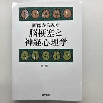 이미지에서 본 뇌경색과 신경심리학