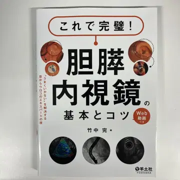 이제 완벽합니다! 담췌관 내시경의 기본과 요령